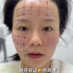 -Yestar艺星医疗美容医院