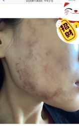 点击看大图 -美壹生诊所皮肤管理中心·海菲秀&Legacy美白舱