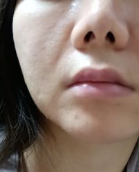 -素美医疗美容·西南眼鼻整形·修复基地