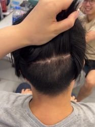 -大麦微针植发全国连锁