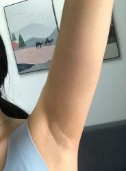 体验后-杭州米兰柏羽医疗美容医院