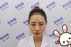 点击看大图 -大麦微针植发丨全国连锁