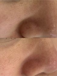 -蕾特恩专业祛痘·皮肤管理