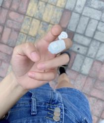 -德哥灰指甲脚气甲沟炎跖疣护理