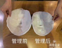 -小颜秘家·韩国整骨