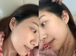 -苗方清颜痘肌研究所