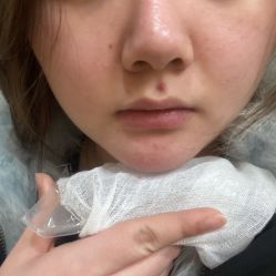 体验后-南京医科大学友谊整形外科医院