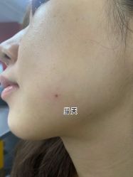 点击看大图 -小忠丽格医美
