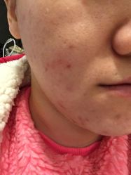 -MedSkinCare科技祛痘肌肤修护中心