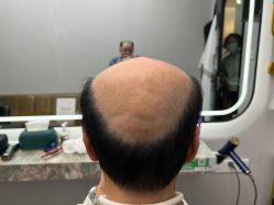 -唐风采假发补发定制