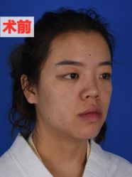 体验前-Yestar艺星医疗美容医院