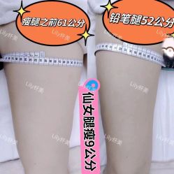 -Lily纤美·科技减脂中心