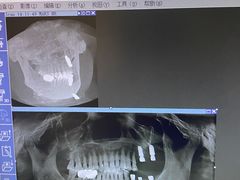 -极光口腔·矫正种植修复(锦江店)