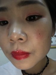 点击看大图 -北京美痣堂古方祛痣斑疣瘊