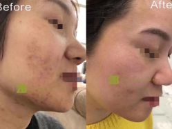 -E.beauty驻颜·痘敏肌调理中心