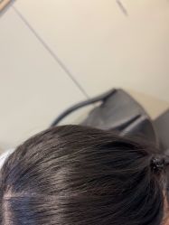 -碧莲盛·不剃发植发