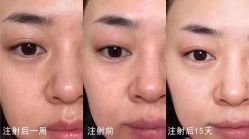 点击看大图 -AURAS璈然科技护肤中心