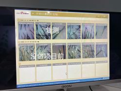 -菩叶脱发白发中心