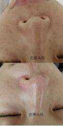 点击看大图 -SKIN79皮肤管理中心