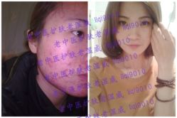 点击看大图 -痘博士广州·全国连锁祛痘机构