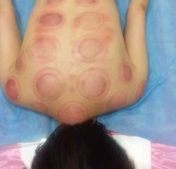 -摩瘦纤体订制减肥