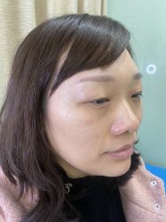 点击看大图 体验前-重庆联合丽格第五医疗美容医院