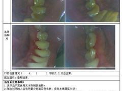 -同步齿科·数字化正畸种植口腔中心(前山店)