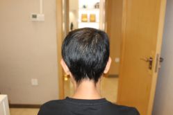 -大麦微针植发丨全国连锁