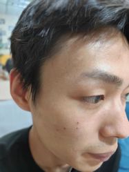 -北京美痣堂古方祛痣斑疣瘊