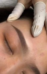 -郡艺医疗美容·微整·眼鼻吸脂