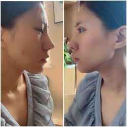 -坤如玛丽·医疗美容中心