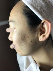 -皇族养心堂·净痘·修敏·御颜