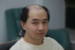 -发饰美男士增发补发假发定制店