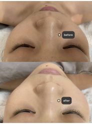 -美愈美肤MEIYU SKIN