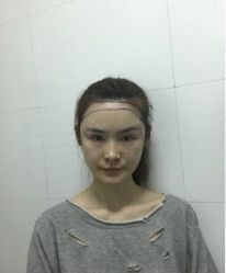 -新生植发·植养护一体