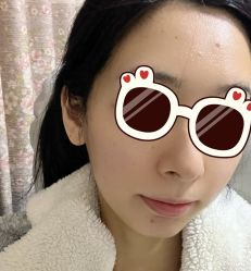 体验后-Yestar 嘉兴艺星医疗美容医院