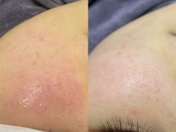 -杉惠素颜美妆皮肤管理中心