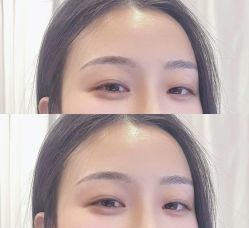 -张小野·专业半永久纹眉