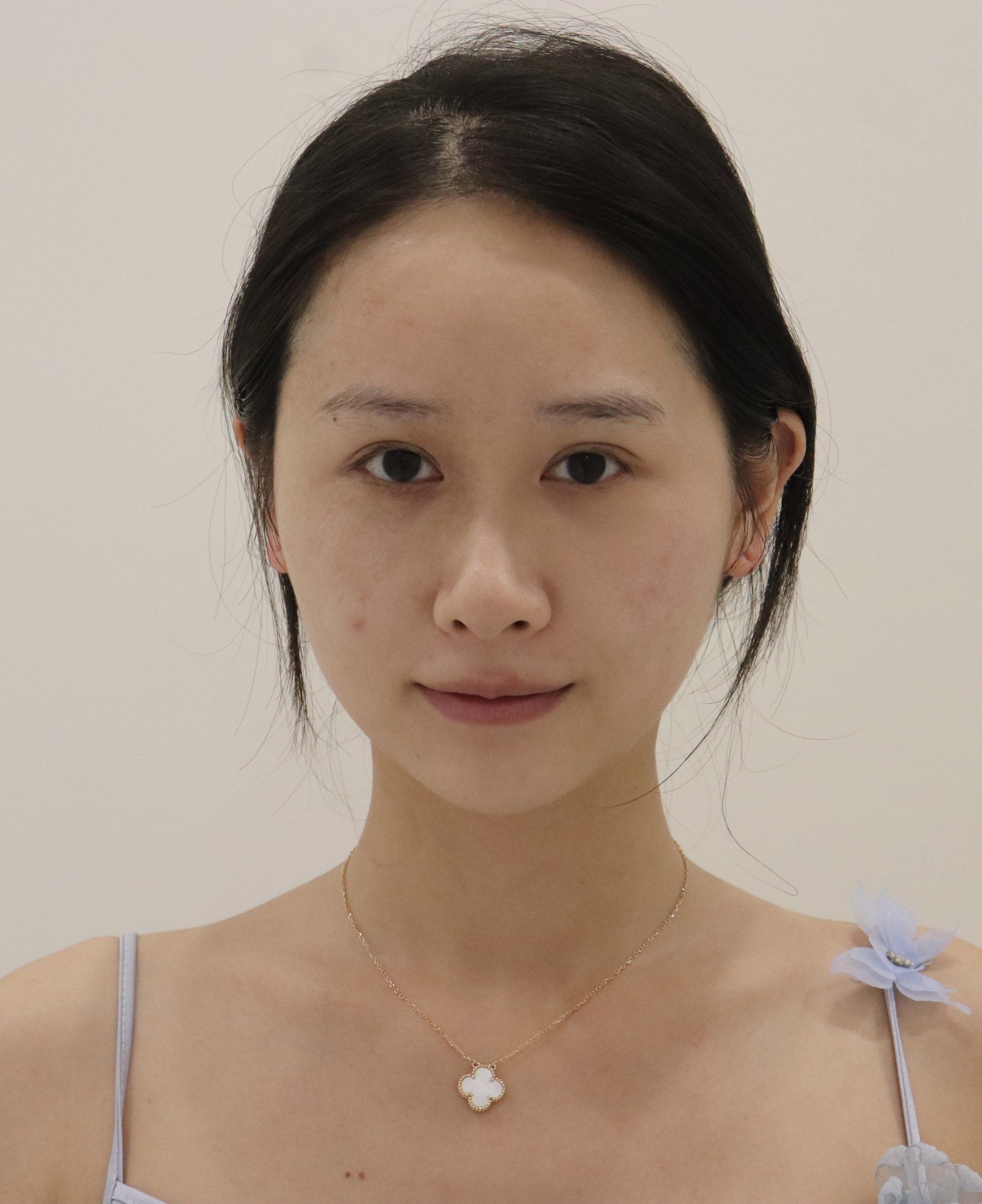 术前变美诉求:
我一直喜欢韩系甜美风格的素颜美女感,这种风格自然