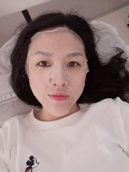 体验后-纯粹医美
