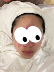 -塑青春&伊肤泉祛痘皮肤管理