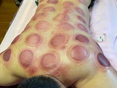 -沈师傅盲人按摩工作室(密三小区店)