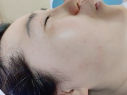 体验前-西安现代妇产医院医疗美容