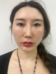 -Yestar杭州艺星医疗美容医院