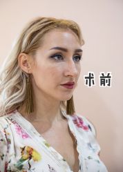 -广州美莱医疗美容医院