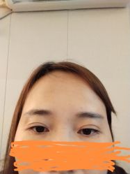 体验后-深圳鹏爱悦心医疗美容医院