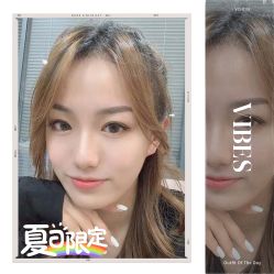 -大麦微针植发全国连锁