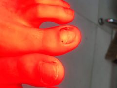 -新甲连锁灰指甲·甲沟炎·鸡眼(黑龙江路店)