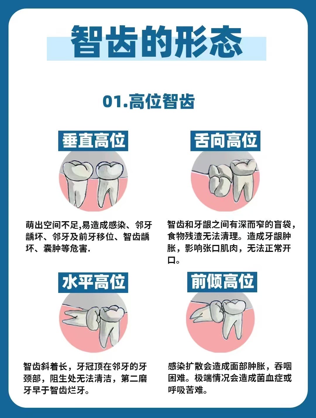 智齿分类图片