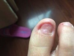 -新甲连锁灰指甲·甲沟炎·鸡眼(黑龙江路店)